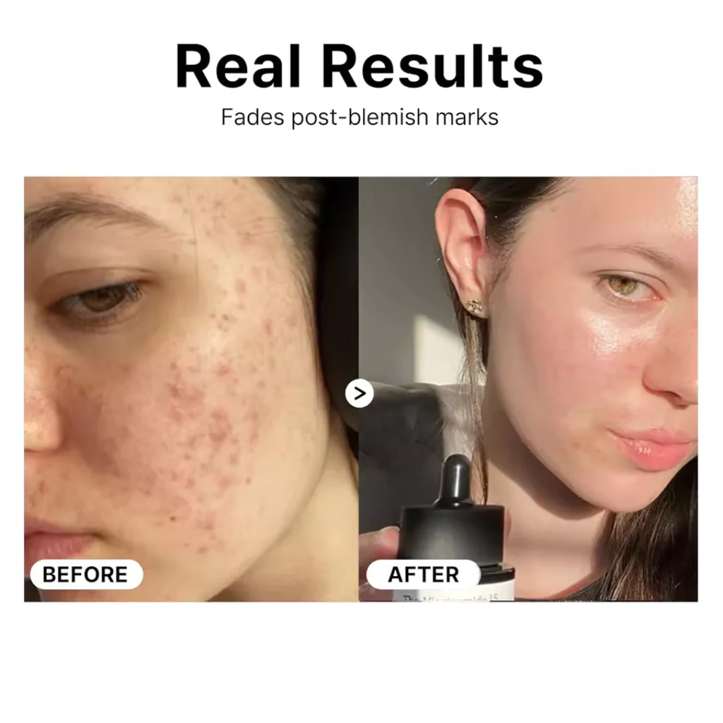 15% Niacinamide Serum - Image 4