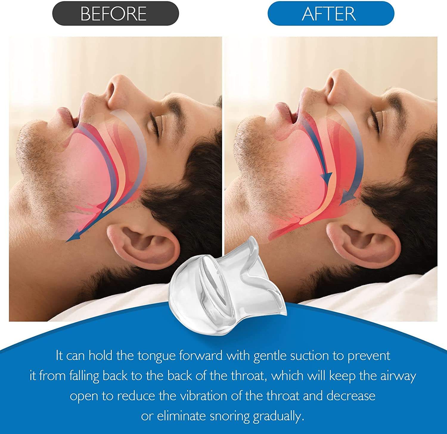 Anti-Snoring Tongue Retainer Mouthpiece - Image 4