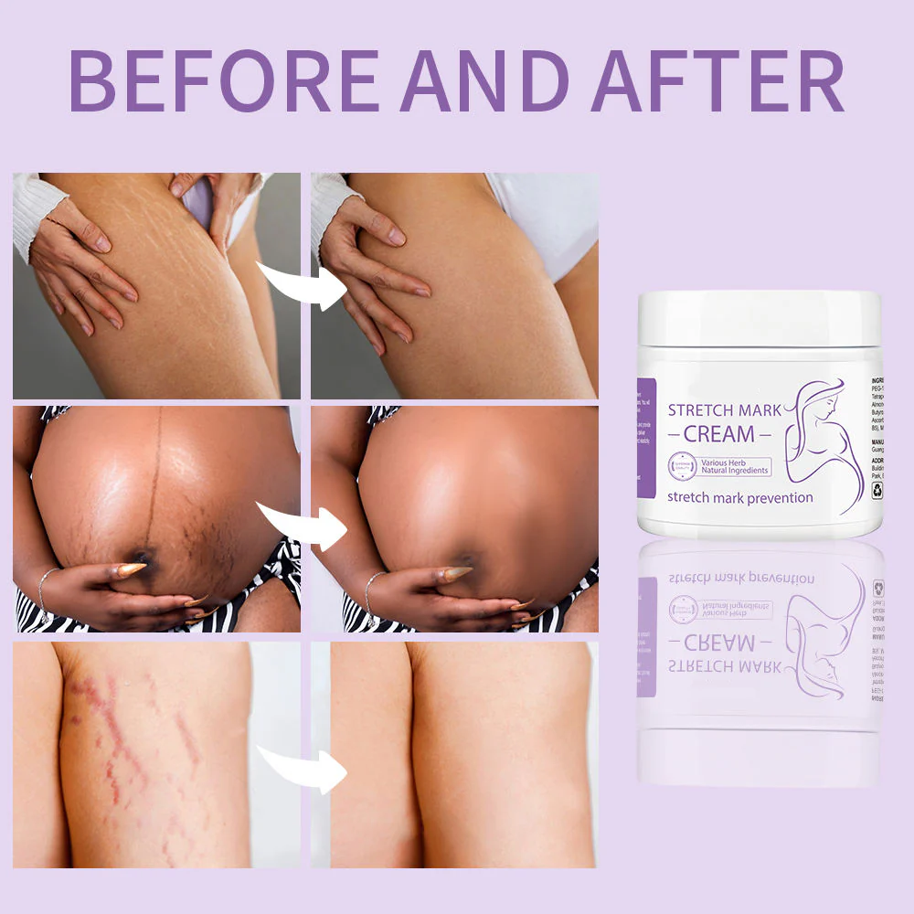 Intensive Stretch Mark Repair Cream - Image 2