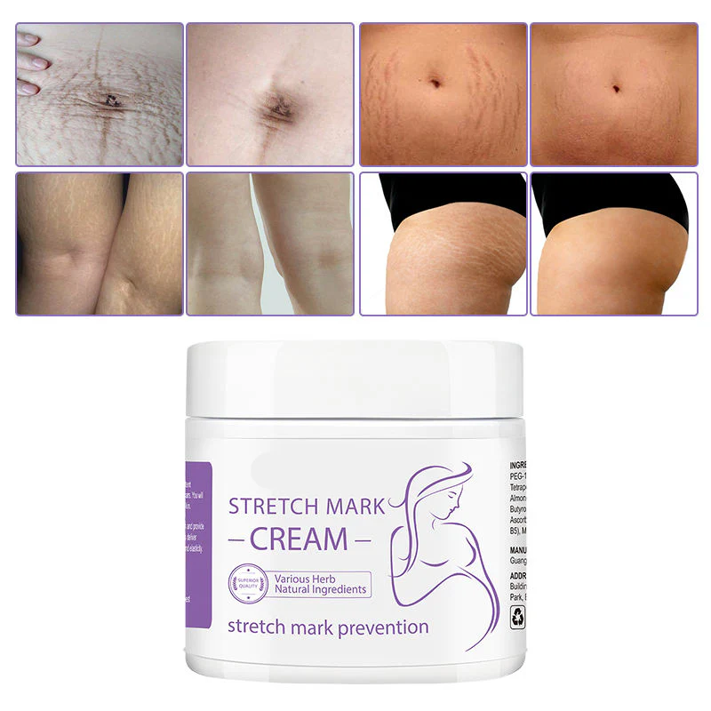 Intensive Stretch Mark Repair Cream - Image 4