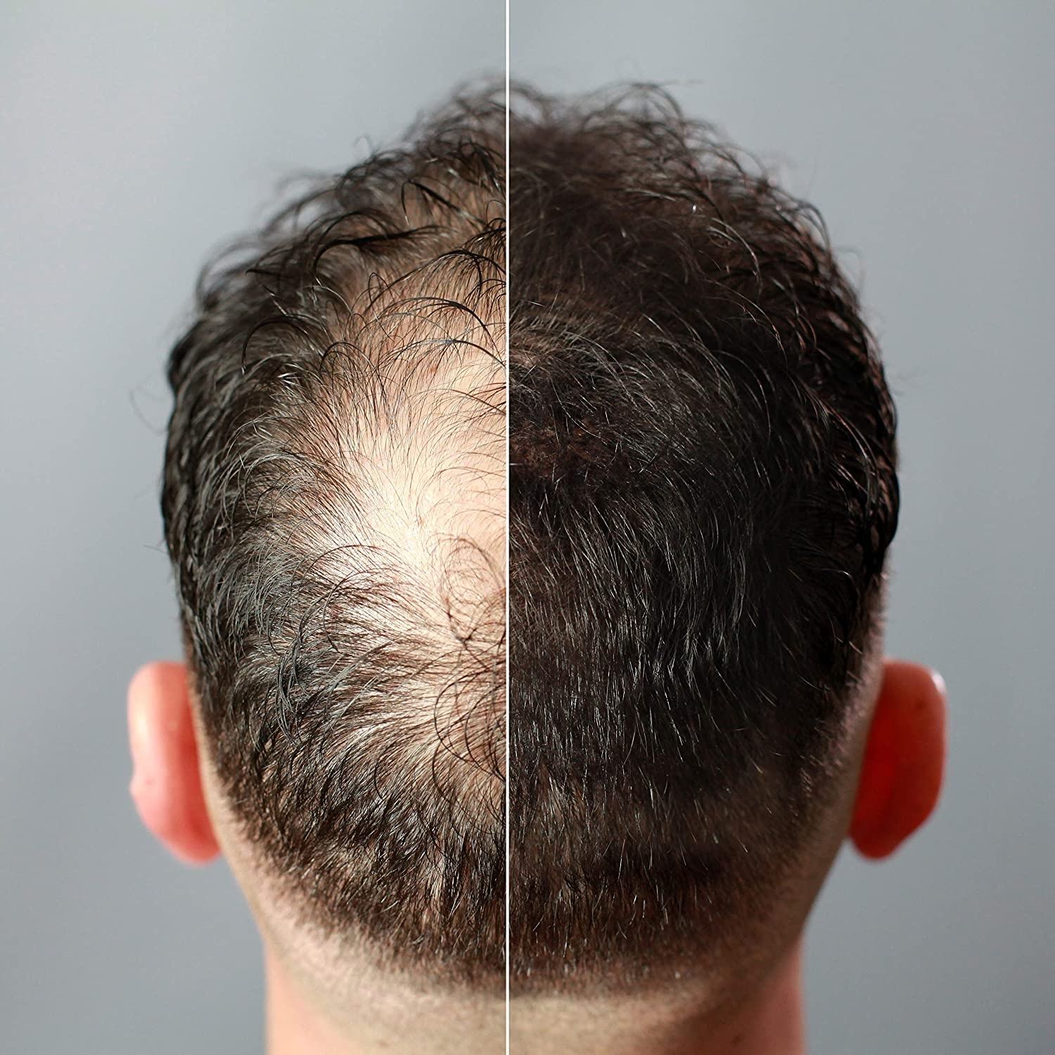 Natural Keratin Fiber for Thinning Hair - Image 4