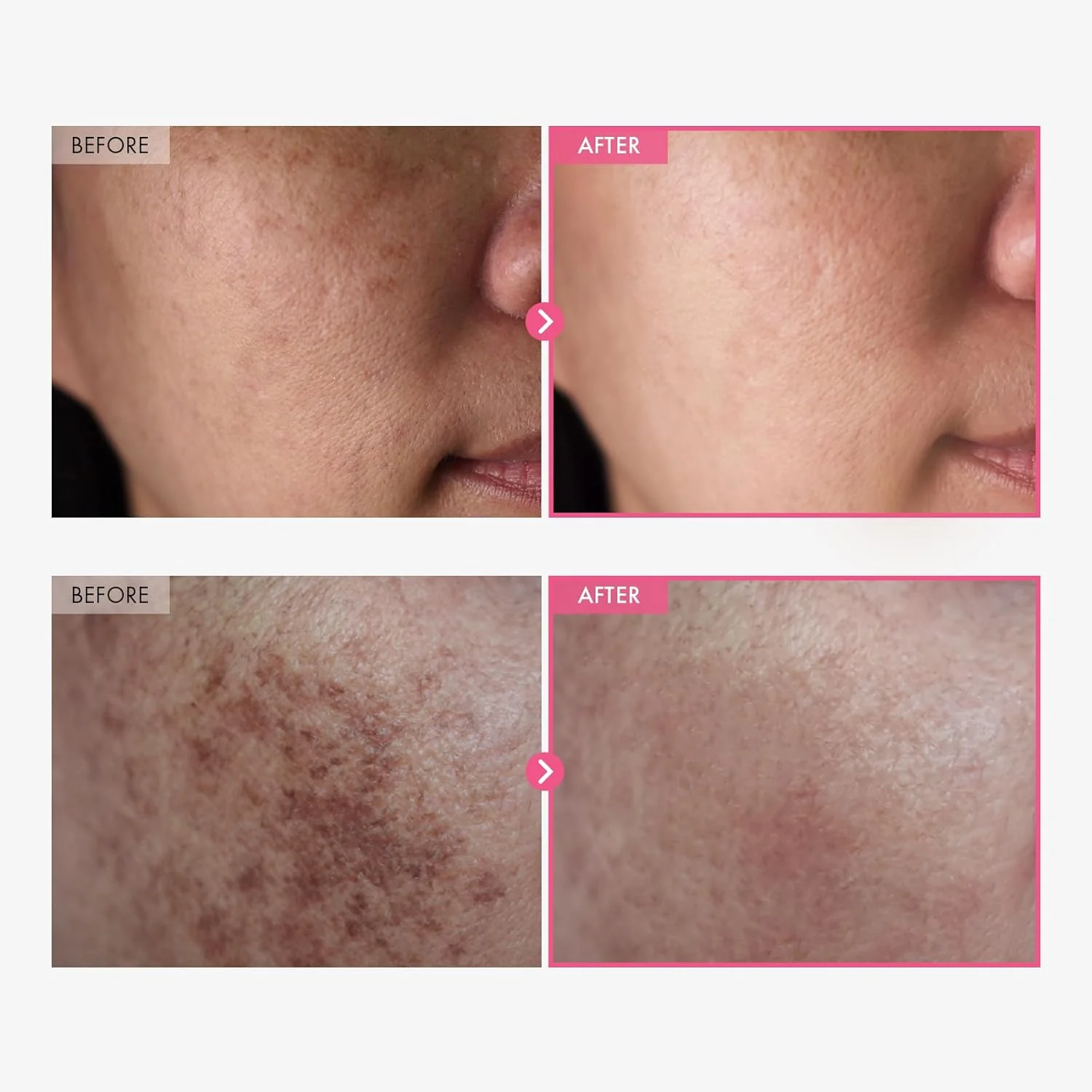 Ultra-Brightening Arbutin & Tranexamic Acid Glow Cream - Image 3